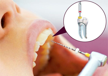 Top dentist in pune