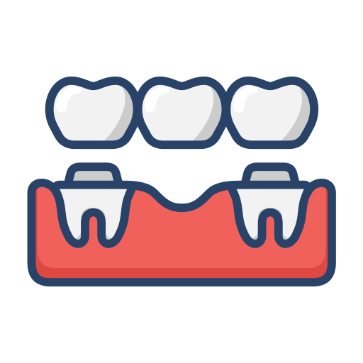 dental crown and bridge treatment in Bibvewadi, Salisbury Park, pune